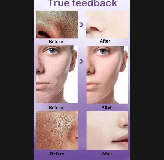 UPTOWN LA-Pore Refining Serum