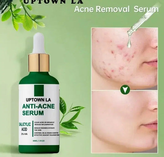 UPTOWN LA-Anti-Acne Face Serum