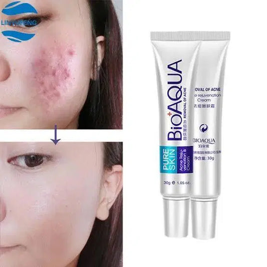 BIOAQUA-Acne Scar Removal Cream